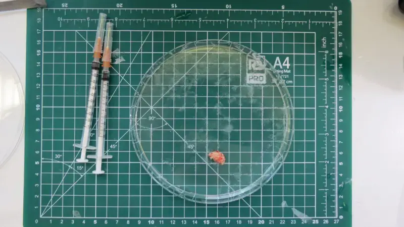 Multi-Front War on Alzheimer's